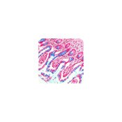Alcian Blue (pH 2.5) Stain Kit